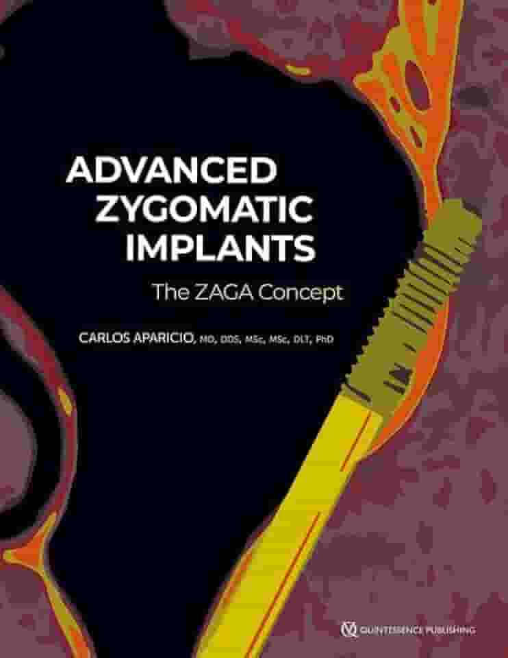 Advanced Zygomatic Implants: The Zaga Concept
