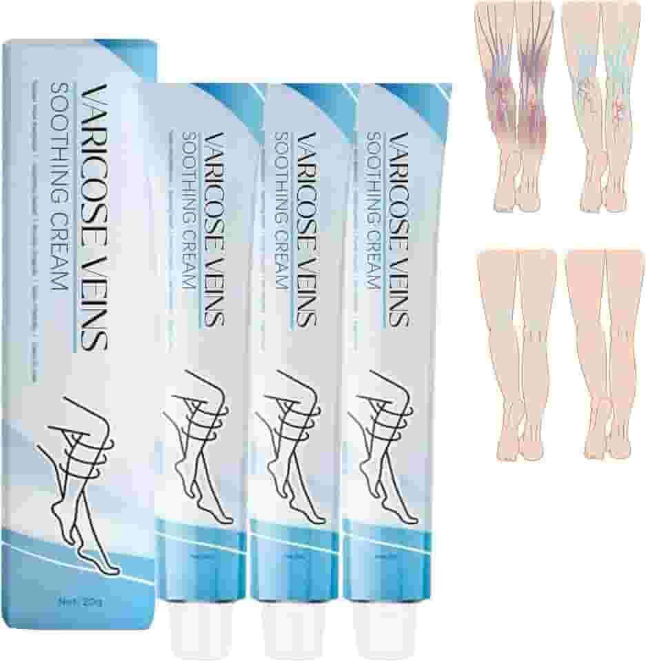 Tratamento Para Varizes Nas Pernas, Creme - Melhora A Circulação Sanguínea, Reduz O Peso (3 Unidades)