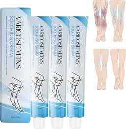 Tratamento Para Varizes Nas Pernas, Creme - Melhora A Circulação Sanguínea, Reduz O Peso (3 Unidades)