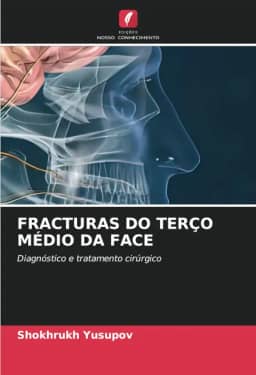 Fracturas Do Terço Médio Da Face: Diagnóstico e tratamento cirúrgico