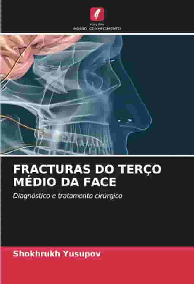 Fracturas Do Terço Médio Da Face: Diagnóstico e tratamento cirúrgico